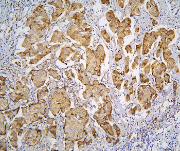 Pyrophosphatase 1/PPA1 Rabbit Polyclonal Antibody