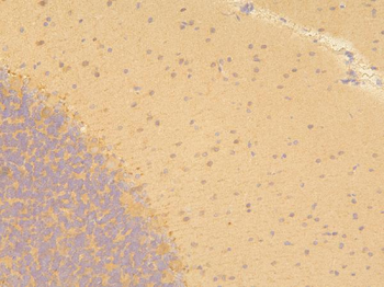 Pyrophosphatase 1/PPA1 Rabbit Polyclonal Antibody