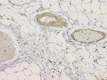 SRCIN1 Rabbit Polyclonal Antibody