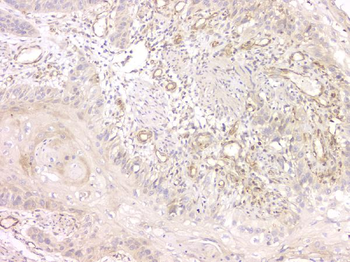 SRCIN1 Rabbit Polyclonal Antibody