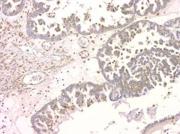 SRCIN1 Rabbit Polyclonal Antibody
