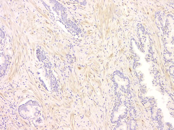 SRCIN1 Rabbit Polyclonal Antibody