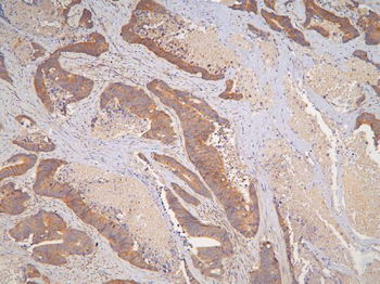 IL-31/IL Rabbit Polyclonal Antibody
