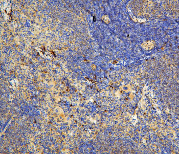 IL-31/IL Rabbit Polyclonal Antibody