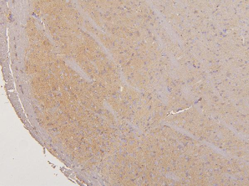 LMTK3 Rabbit Polyclonal Antibody