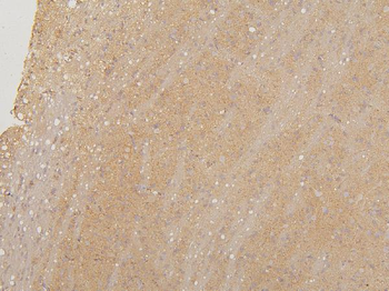 LMTK3 Rabbit Polyclonal Antibody