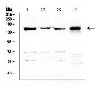 LMTK3 Rabbit Polyclonal Antibody