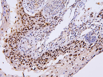 BHC80/PHF21A Rabbit Polyclonal Antibody