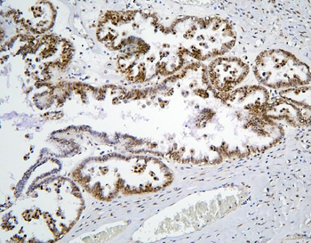 BHC80/PHF21A Rabbit Polyclonal Antibody