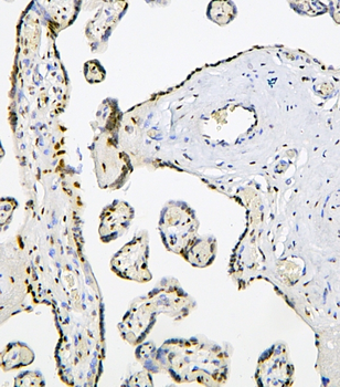 BHC80/PHF21A Rabbit Polyclonal Antibody