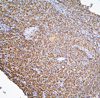 BHC80/PHF21A Rabbit Polyclonal Antibody