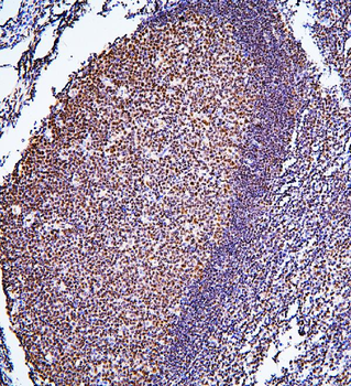 BHC80/PHF21A Rabbit Polyclonal Antibody