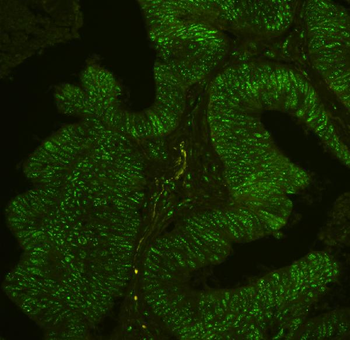 BHC80/PHF21A Rabbit Polyclonal Antibody