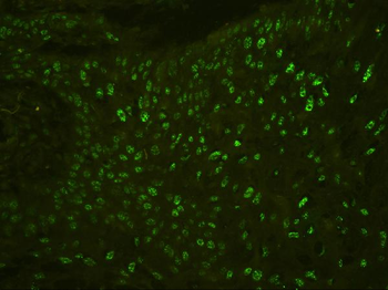 BHC80/PHF21A Rabbit Polyclonal Antibody