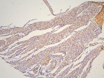 BHC80/PHF21A Rabbit Polyclonal Antibody