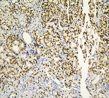 BHC80/PHF21A Rabbit Polyclonal Antibody