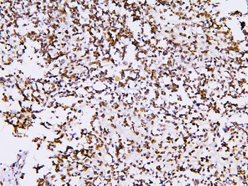 BHC80/PHF21A Rabbit Polyclonal Antibody