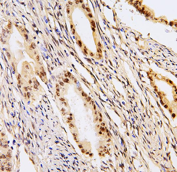 BHC80/PHF21A Rabbit Polyclonal Antibody
