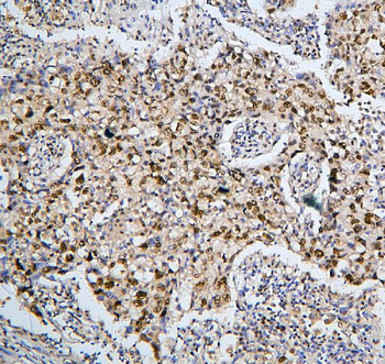 BHC80/PHF21A Rabbit Polyclonal Antibody