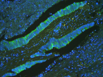 ATP5G1,2,3/ATP5MC1,2,3/ATP5G1 Rabbit Polyclonal Antibody