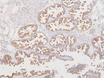 ATP5G1,2,3/ATP5MC1,2,3/ATP5G1 Rabbit Polyclonal Antibody