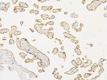 ATP5G1,2,3/ATP5MC1,2,3/ATP5G1 Rabbit Polyclonal Antibody