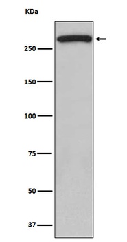 ATM Rabbit Monoclonal Antibody
