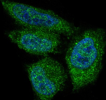 AKT1 Rabbit Monoclonal Antibody