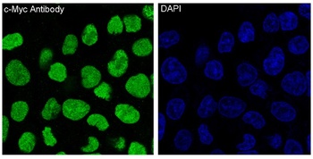 c-Myc Rabbit Monoclonal Antibody
