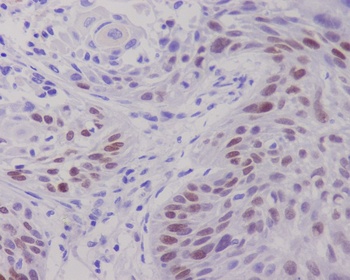c-Myc Rabbit Monoclonal Antibody