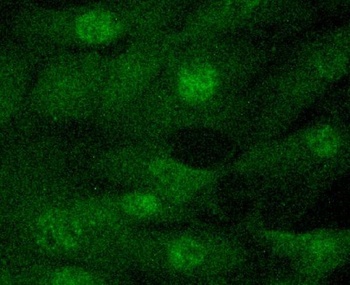 JAK2 Rabbit Monoclonal Antibody