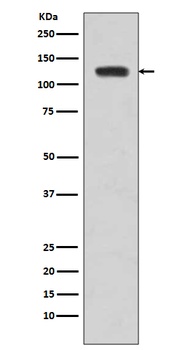 JAK2 Rabbit Monoclonal Antibody