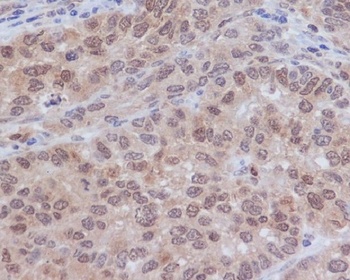 ERK2 Rabbit Monoclonal Antibody