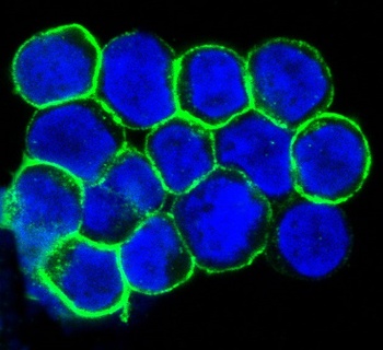 CXCR4 Rabbit Monoclonal Antibody