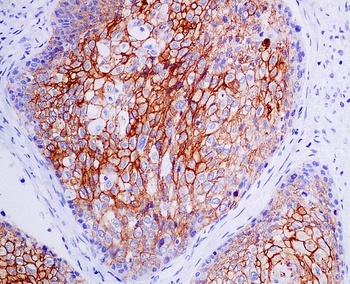 CXCR4 Rabbit Monoclonal Antibody