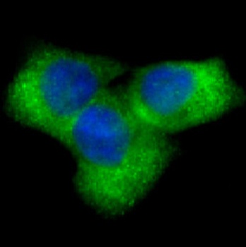 Notch1 Rabbit Monoclonal Antibody