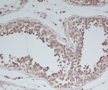 BDNF Rabbit Monoclonal Antibody