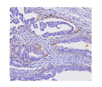 STAT1 Mouse Monoclonal Antibody