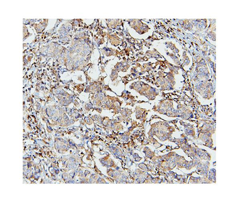 STAT1 Mouse Monoclonal Antibody
