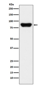 Prothrombin F2 Rabbit Monoclonal Antibody