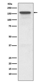 P Glycoprotein ABCB1 Rabbit Monoclonal Antibody