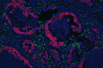 E Cadherin 1 CDH1 Mouse Monoclonal Antibody