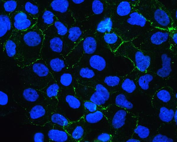 E Cadherin 1 CDH1 Mouse Monoclonal Antibody