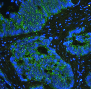 E Cadherin 1 CDH1 Mouse Monoclonal Antibody