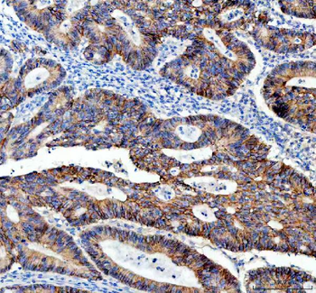 E Cadherin 1 CDH1 Mouse Monoclonal Antibody