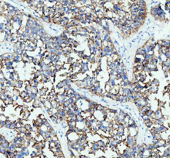 E Cadherin 1 CDH1 Mouse Monoclonal Antibody