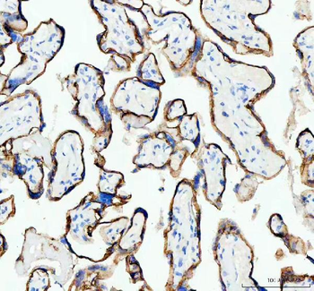 E Cadherin 1 CDH1 Mouse Monoclonal Antibody