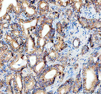 E Cadherin 1 CDH1 Mouse Monoclonal Antibody