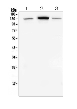 E Cadherin 1 CDH1 Mouse Monoclonal Antibody