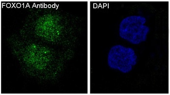 FoxO1a Rabbit Monoclonal Antibody